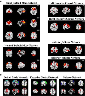 Altered Functional Connectivity in a Triple-Network Model in Autism With Co-occurring Attention Deficit Hyperactivity Disorder